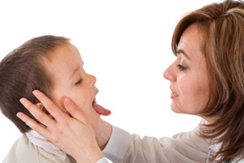 4 cách đơn giản phòng và điều trị các bệnh ở miệng của trẻ 1